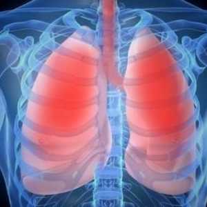 Simptomi bronhitisa pri odraslih