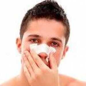 Poškodbe in ukrivljenost nosu