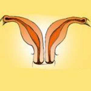Dvojne maternice in vagine