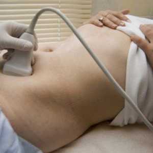 Uzi ledvic in mehurja (ultrazvok)