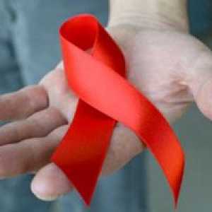 Okužbe s HIV in AIDS-